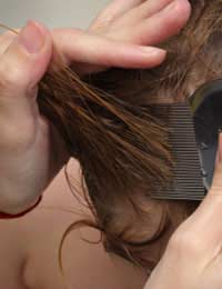 Hair Hair Parasites Hair Loss Parasites