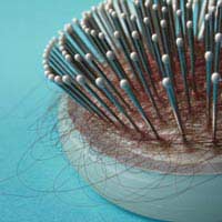 Anaemia Hair Loss Telogen Effluvium Iron