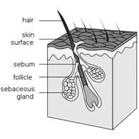 Piedra Hair Loss Fungus Fungal Infection