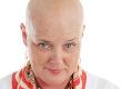 Why Has My Hair Grown Back Differently After Cancer Treatment?