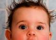 Infant Hair Loss