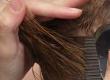 Can Head Lice and Parasites Cause Hair Loss?