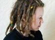 Dreadlocks and Hair Loss