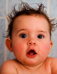 Infant Hair Loss Baby Child Cradle Cap