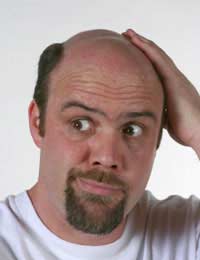 Hair Loss Male Pattern Baldness Electric